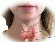 Thyroid Abnormality Screening