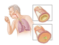 Pulmonary Function Screening